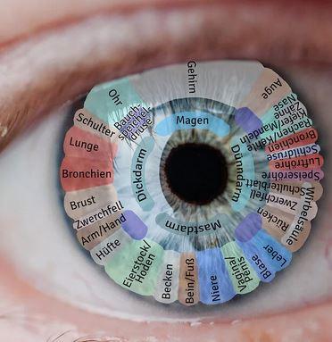 Irisdiagnostik